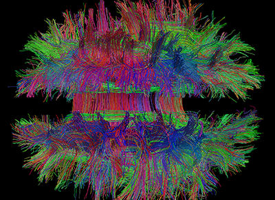 neuroimaging