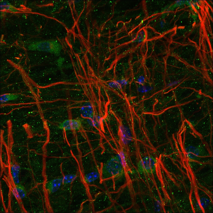 Spinal cord image showing neuronal and astrocyte cells