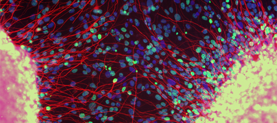 Human neural stem cells in culture